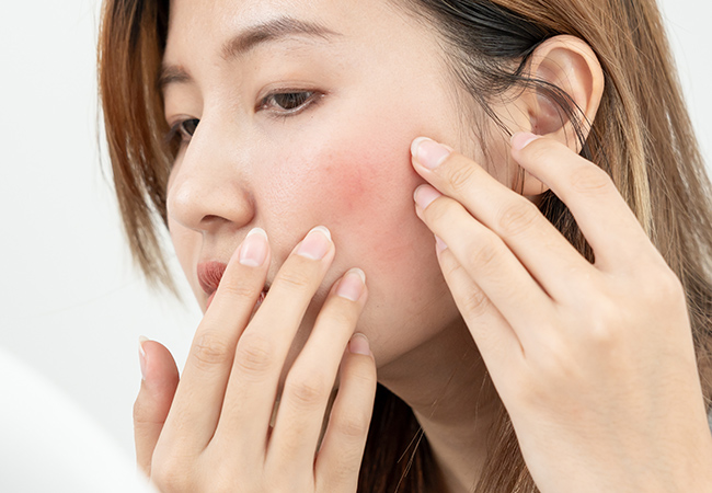 顔の赤みを気にする女性