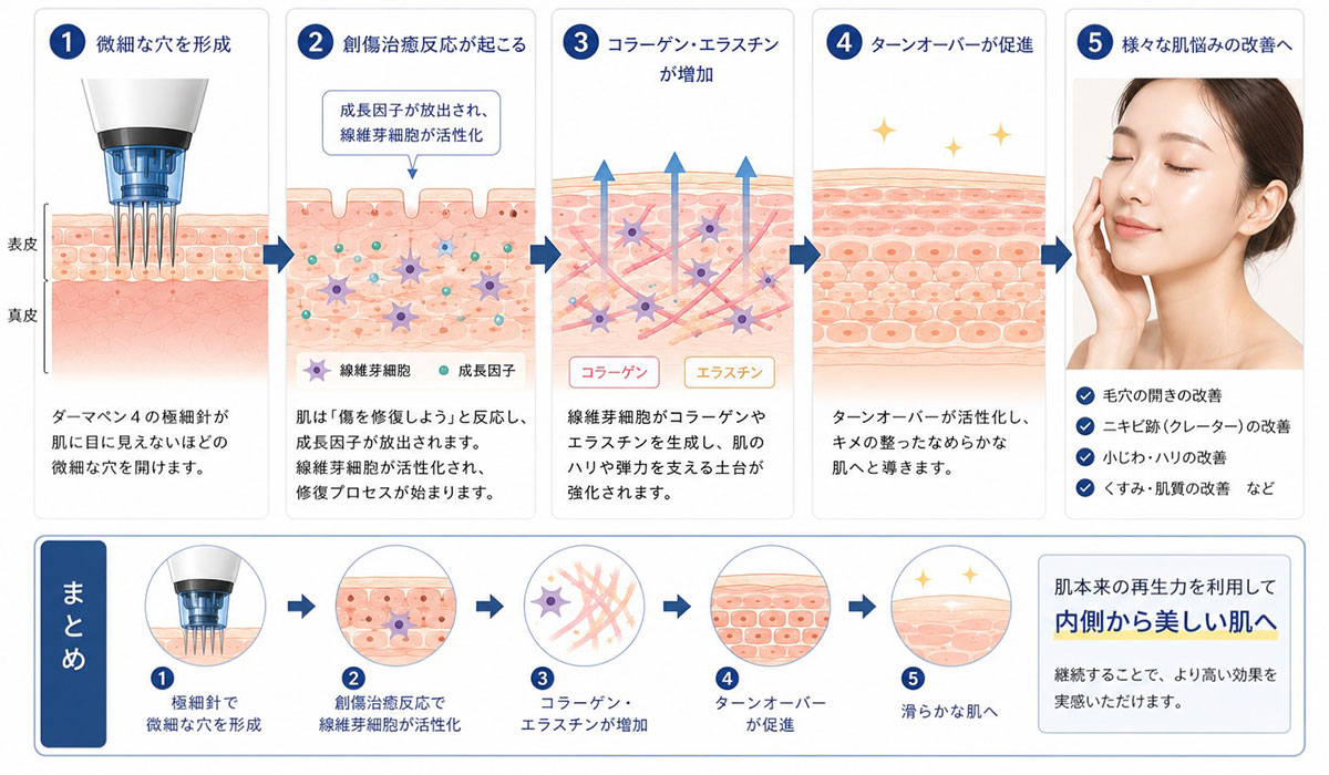 作用機序