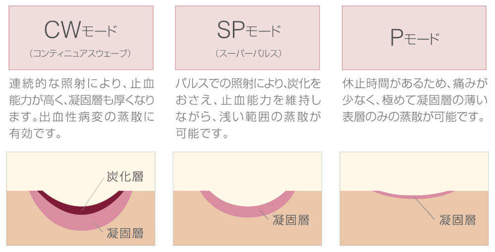 3つの発振モード